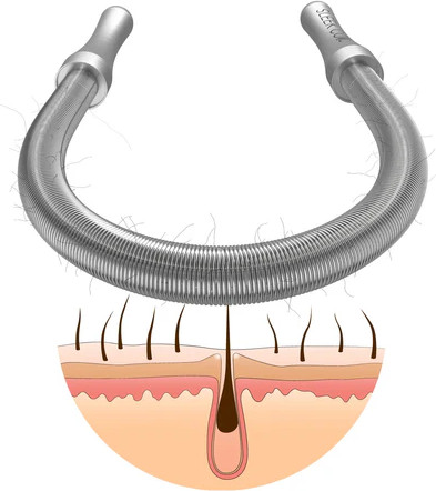 SleekCoil קפיץ להסרת שיער הפנים