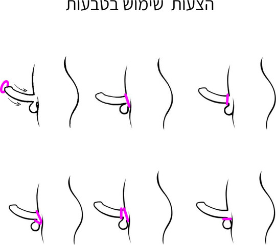 קונטרול רינג זוג טבעות אלסטיות