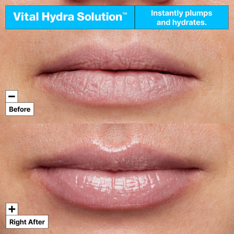 vital hydra solution  מסכת לחות לשפתיים