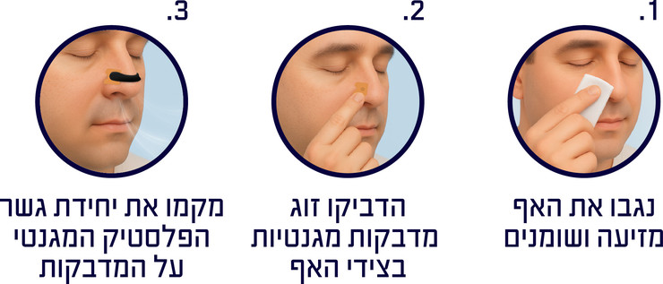 מרחיב נחיריים מגנטי – מסייע בהגדלת זרימת האוויר דרך האף