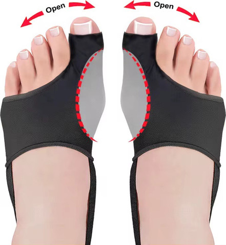 סד מפריד אצבעות עם רצועה לתיקון בוהן קלובה ToeAlign