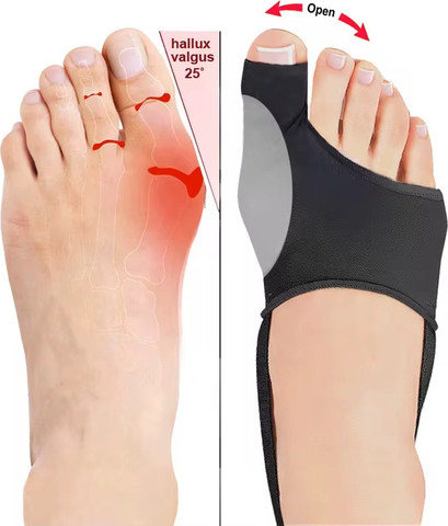 סד מפריד אצבעות עם רצועה לתיקון בוהן קלובה ToeAlign