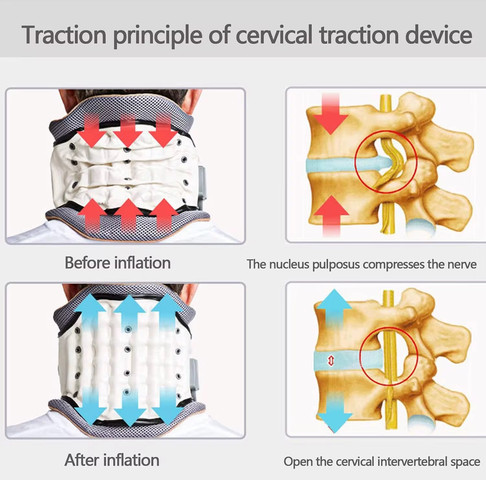 צווארון תומך צוואר מתנפח להקלה על כאבי צוואר NeckAir