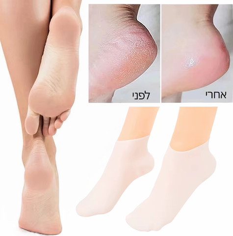 גרבי סיליקון להזנה וריכוך כף הרגל – טיפול לעור יבש וסדוק Silksocks
