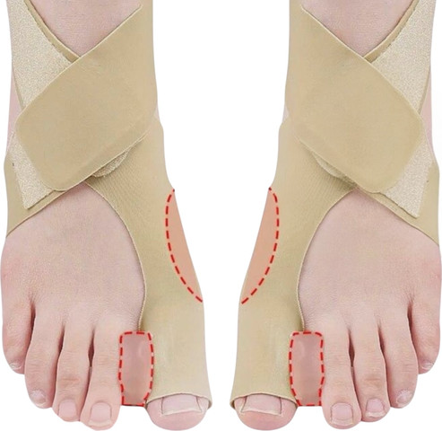 סד ליישור בוהן Toe Aligner