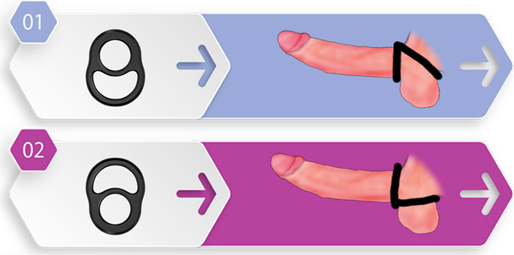 טבעת מפצלת נמתחת Smile Ring