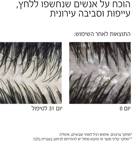 דרקוס שמפו נגד קשקשים לקרקפת יבשה