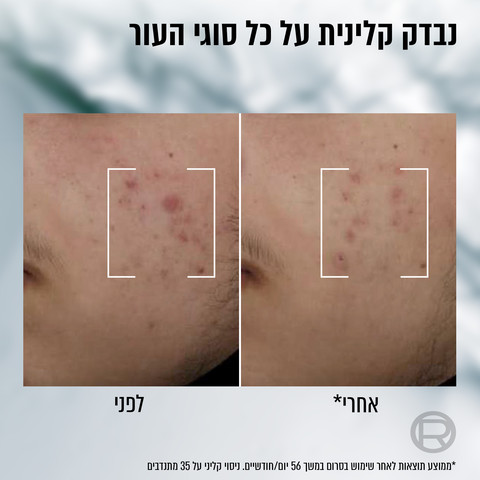 DERMA CONTROL SOS סרום