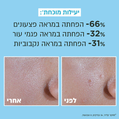 PURE ACTIVE תחליב לחות UV ניאצינאמיד SPF50