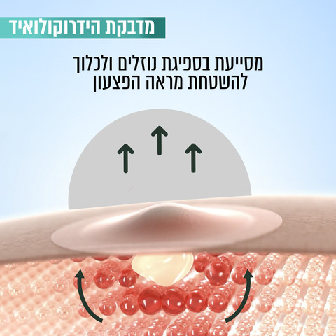 PURE ACTIVE מדבקות פצעונים