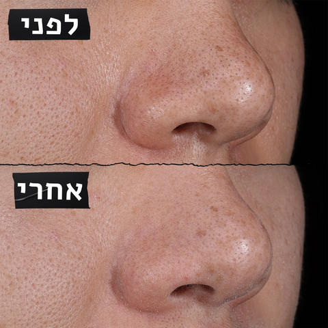 RARE EARTH מסכת חימר לצמצום מראה הנקבוביות