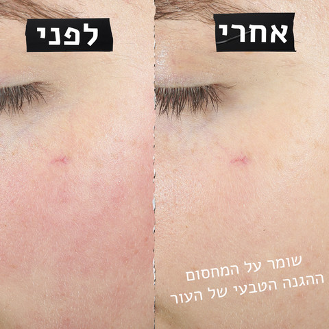ULTRA FACIAL קרם פנים משקם לעור רגיש
