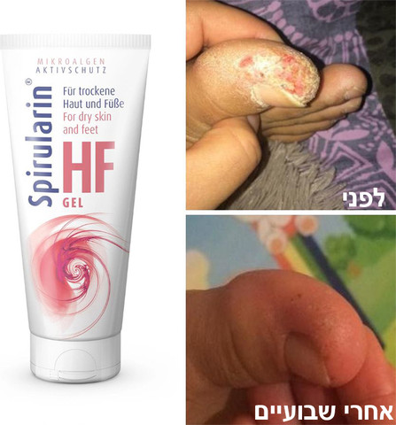 ג'ל טיפולי, לחות והגנה  לעור רגיש ויבש בכפות הרגליים, ג'ל טיפולי לטיפול בפטרת העור (מיקוזיס) ודרמטיטיס, הקלה בפסוראזיס Spirularin® HF Gel