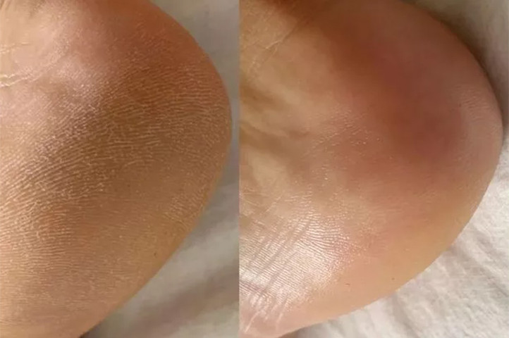 Calendula Foot Cream קרם רגליים קלנדולה לשיקום ולהגנה