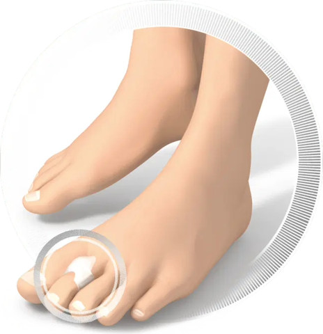 Protective Padding Ring טבעת הגנה סיליקונית ליבלות