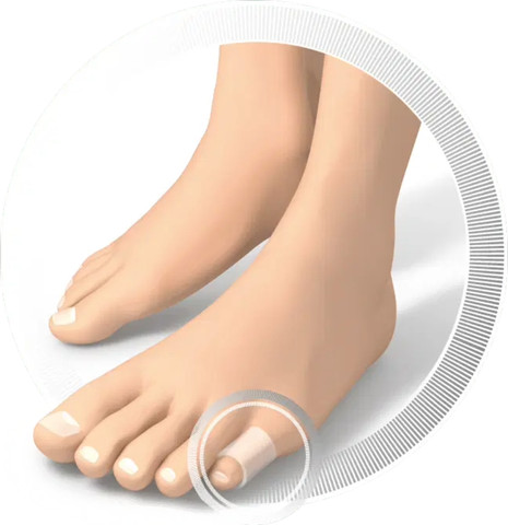 Toe Separators מפרידי אצבעות