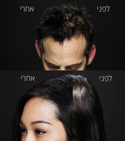 טופיק סיבי שיער למילוי שיער דליל 12 גרם גוון חום בהיר /LIGHT BROWN