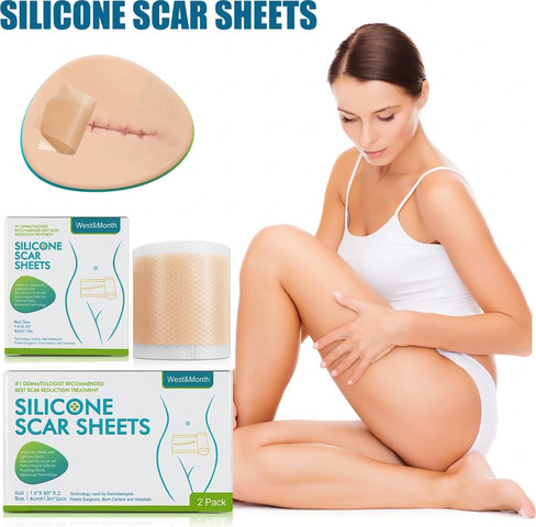 רצועת סיליקון להפחתת צלקות anti scar, שיפור מראה צלקת ועור והחלמה מהירה