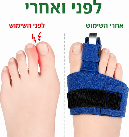 מיישר אצבע פטיש Hammer Toe Splint | סד ליישור ותמיכה באצבעות כף הרגל