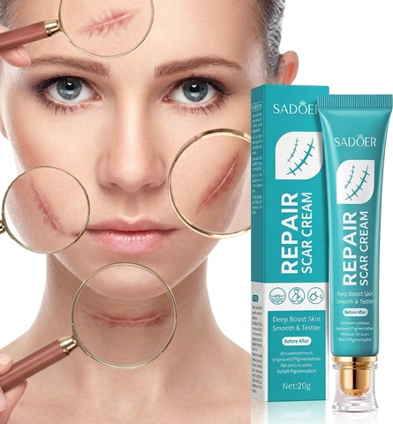 קרם סיליקון להפחתת צלקות anti scar, שיפור מראה צלקת ועור והחלמה מהירה