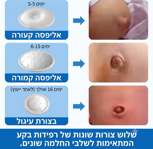 חגורת בקע טבורי/תבורי לתינוק עם כרית לחץ ייעודית