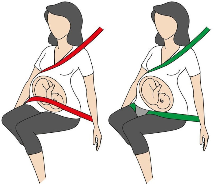 חגורת בטיחות לנשות הרות BeSafe Pregnant