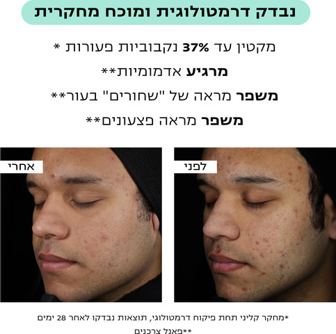 CLEAR טונר לחידוש העור פילינג וכיווץ נקבוביות