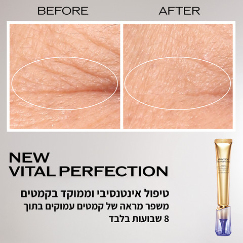 VITAL PERFECTION טיפול אינטנסיבי וממוקד לקמטים וכתמי עור