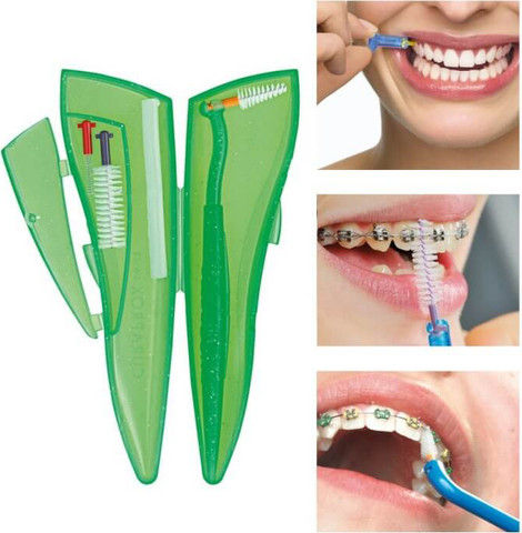 קורפרוקס ערכת כיס לגשר, צבע רנדומלי Ortho Pocket Set