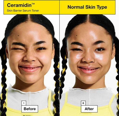 ceramidin טונר סרום לחיזוק מחסום העור