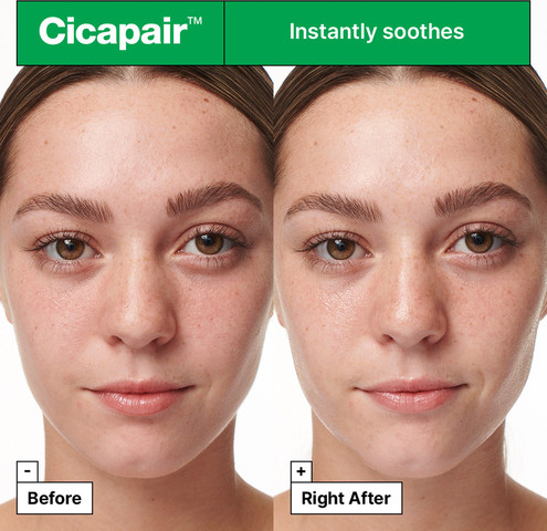 cicapair סרום להרגעה ותיקון מסום העור
